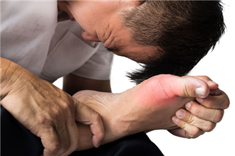 9 nguyên nhân làm tăng nguy cơ mắc bệnh gút