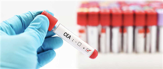 Ưu nhược điểm của các tầm soát ung thư
