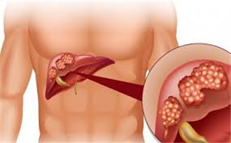 Bệnh viêm gan ảnh hưởng tới “chuyện ấy” thế nào?