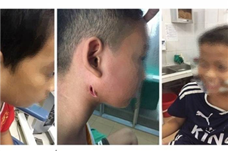 Cảnh báo vi khuẩn 